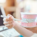 歯の神経を守るための予防とケア