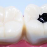 高齢者も電動歯ブラシを使っていいいの？