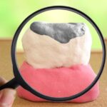 「アマルガム」をご存知ですか？